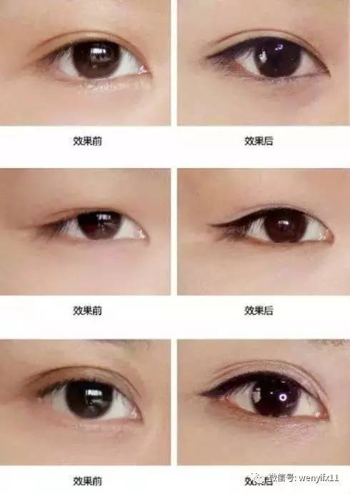 【三亿体育官网】医用气体管道系统设计(图2) 三亿体育官网