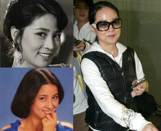 射精带血?前列腺炎到血精症至男性不育的病因与治疗有哪些?‘三亿体育官网’(图4) 三亿体育